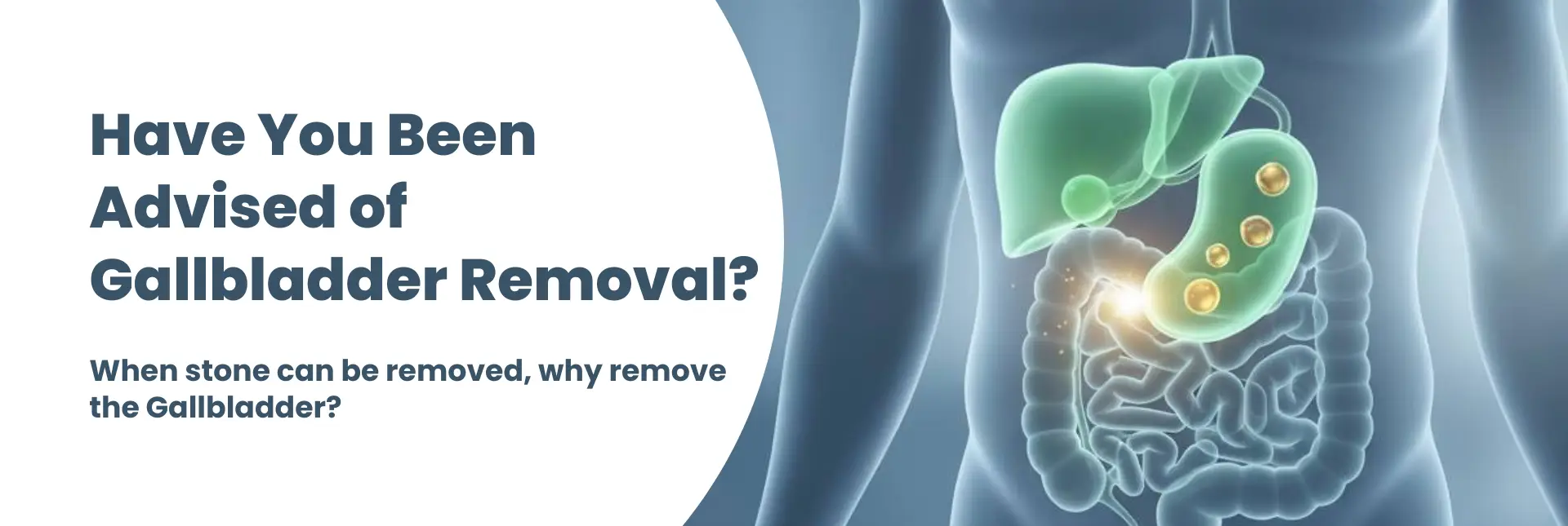 gallbladder-removal-banner